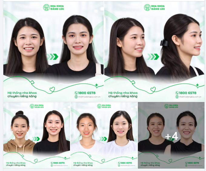 Chúng ta nhất định sẽ tự tin hơn khi chúng ta có một nụ cười đẹp