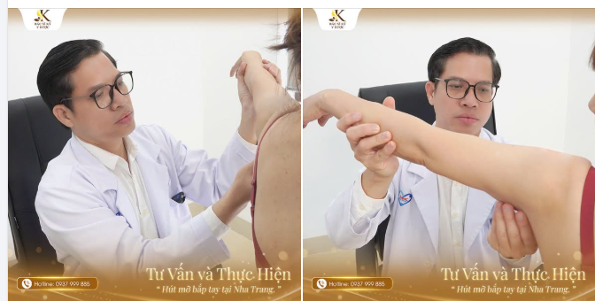 Cánh tay kém thon gọn, mỡ tích tụ vùng nách khiến nàng chưa tự tin khi diện áo sát nách hay những thiết kế yêu thích?
