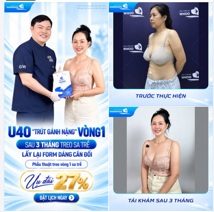 U40 “TRÚT GÁNH NẶNG” VÒNG 1 – SAU 3 THÁNG TREO SA TRỄ, LẤY LẠI FORM DÁNG CÂN ĐỐI