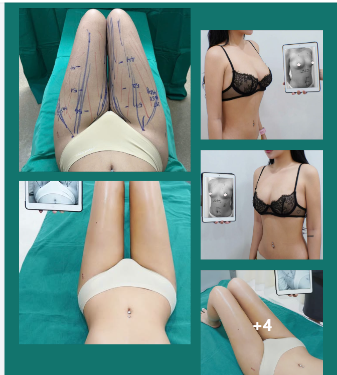 LẤY CHỖ THỪA – BÙ CHỖ THIẾU