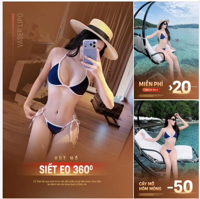 SIẾT EO 360° – THÊM CẤY MỠ HÕM MÔNG, ƯU ĐÃI GIẢM 50%