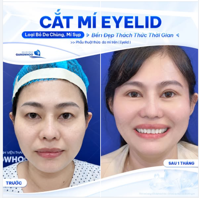 TỪ ÁNH NHÌN NẶNG NỀ ĐẾN ĐÔI MẮT GỌN GÀNG