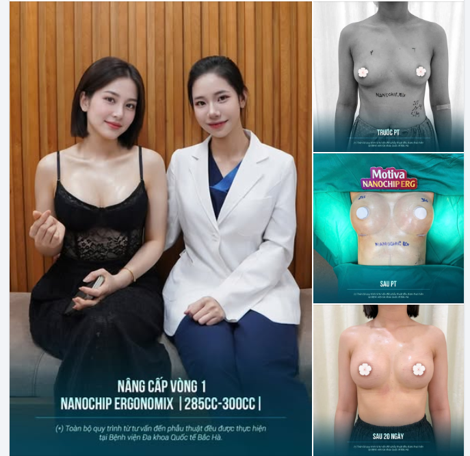 NÂNG CẤP VÒNG 1 VỚI NANOCHIP ERGONOMIX: NHÌN LẠI SỰ THAY ĐỔI QUA FEEDBACK THỰC TẾ