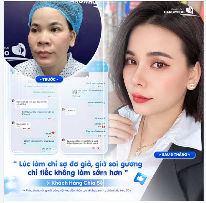 TỪ LO LẮNG ĐẾN TIẾC VÌ KHÔNG NÂNG MŨI SỚM HƠN