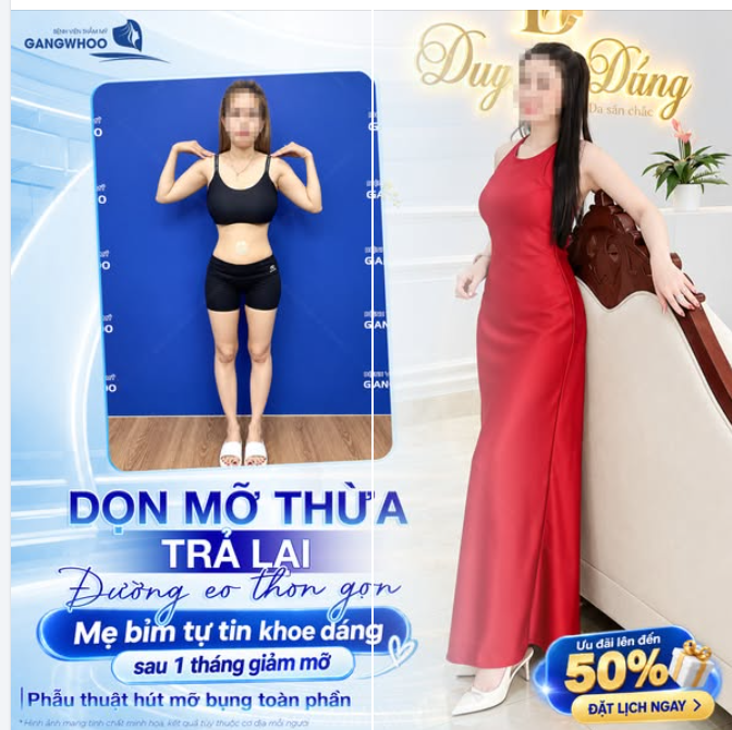 DỌN MỠ THỪA, TRẢ LẠI ĐƯỜNG EO THON GỌN - MẸ BỈM TỰ TIN KHOE DÁNG SAU 1 THÁNG GIẢM MỠ BỤNG
