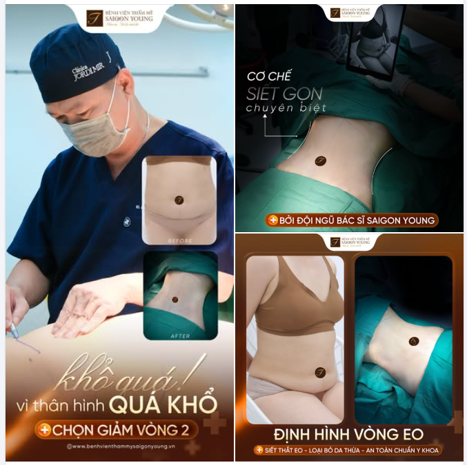 KHÔNG CÒN NỖI KHỔ TỪ VÓC DÁNG QUÁ KHỔ - CHỌN HÚT MỠ VÒNG 2