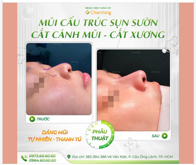 GÓC NGHIÊNG THĂNG HẠNG LÀ CẢM GIÁC NHƯ THẾ NÀO?