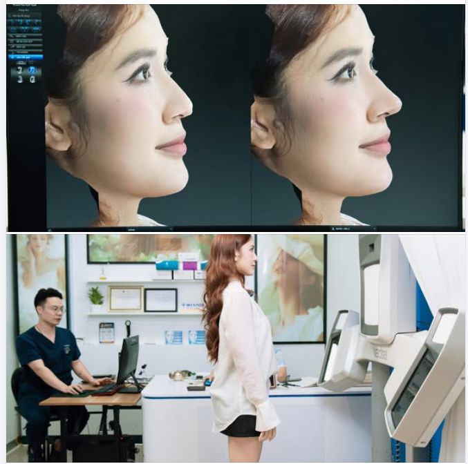 Muốn xem dáng mũi sau làm và đây là cách nhanh nhất để DJ Emma biết sau phẫu thuật mình trông như thế nào?