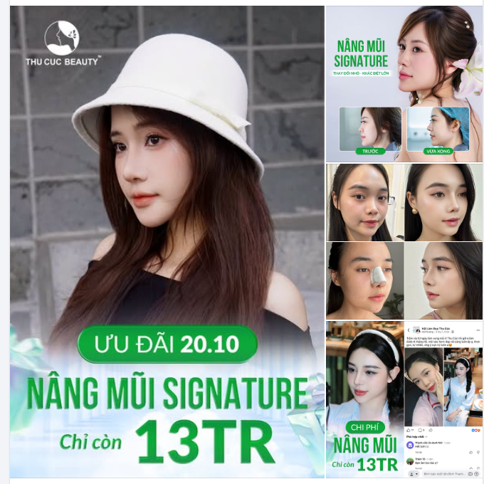 ĐẶC QUYỀN 20/10 - NÂNG MŨI SIGNATURE CHỈ CÒN 13 TRIỆU