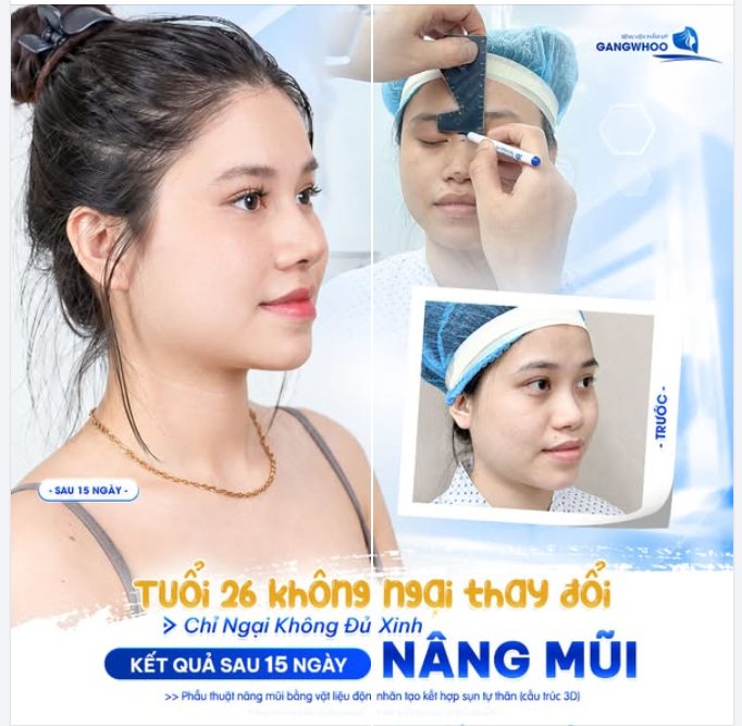 TUỔI 26 KHÔNG NGẠI THAY ĐỔI - CHỈ NGẠI KHÔNG ĐỦ XINH