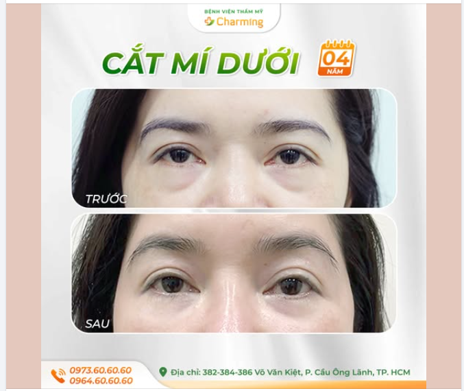 “4 NĂM SAU QUAY LẠI, EM VẪN HÀI LÒNG VỚI QUYẾT ĐỊNH NGÀY ẤY…”