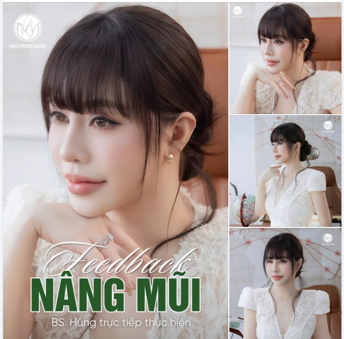 Người ta nâng cấp điện thoại, chị em mình nâng cấp luôn dáng mũi!