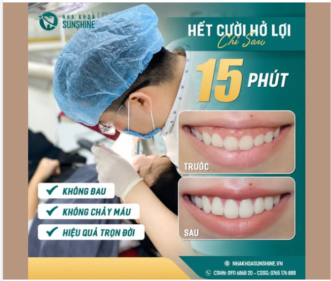 HẾT CƯỜI HỞ LỢI CHỈ SAU 15 PHÚT — LẤY LẠI NỤ CƯỜI DUYÊN RẠNG RỠ!"