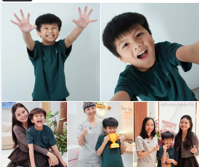HÀNH TRÌNH NIỀNG RĂNG CỦA CHÚ BÉ KHOAI ĐÃ CHÍNH THỨC HOÀN TẤT!