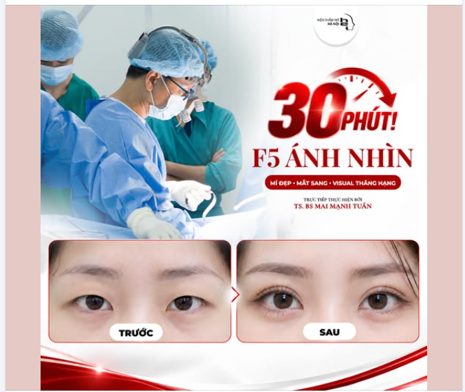 NHẤN MÍ OVAL LINE WIDE DEEP – F5 ÁNH NHÌN, THĂNG HẠNG VISUAL