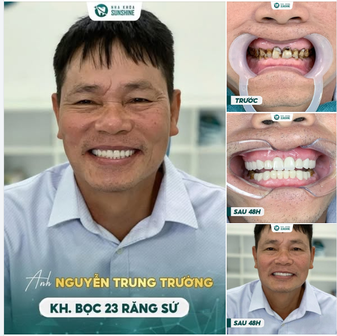 "GIẢI CỨU NỤ CƯỜI TRUNG NIÊN: MÀN LỘT XÁC CỦA ANH NGUYỄN TRUNG TRƯỜNG!"