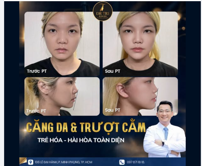COMBO HOÀN HẢO: CĂNG DA MẶT VÀ TRƯỢT CẰM