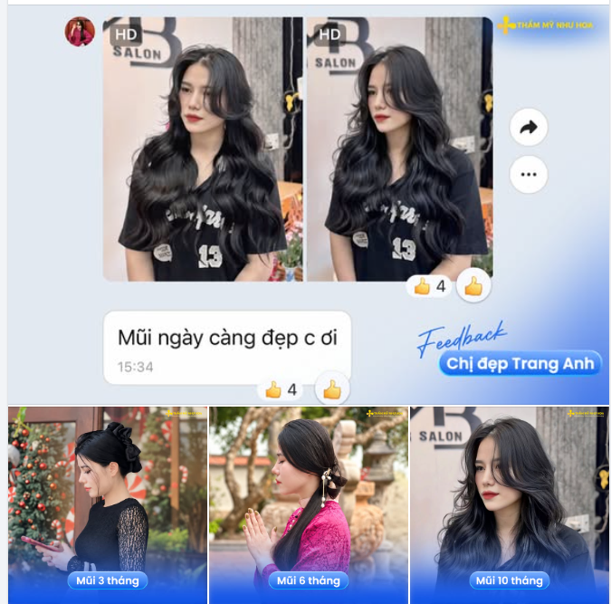 10 tháng sau nâng mũi Golden Line, chị đẹp Trang Anh dành lời khen: "Mũi càng ngày càng đẹp"