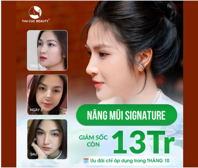 Nâng mũi Signature - kiến tạo dáng mũi hài hòa