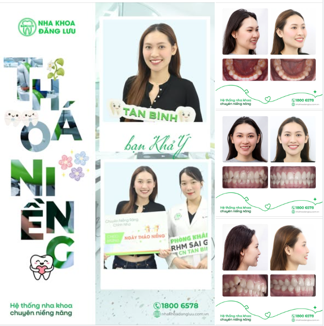 KHẢ Ý THÁO NIỀNG RỒI NÈ 