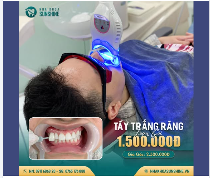 "TẨY TRẮNG RĂNG BẬT 3–5 TONE - SỞ HỮU NGAY NỤ CƯỜI TỎA SÁNG CẤP TỐC!"