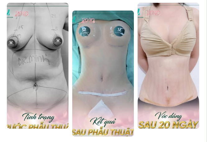 20 NGÀY – VÓC DÁNG ĐÃ “LÊN FORM” ĐẾN ĐÂU?