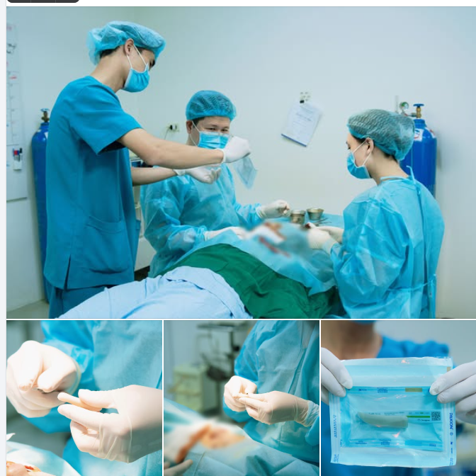 Chị đẹp đã bao giờ thắc mắc chất liệu sụn được đưa vào mũi mình trông như thế nào, đến từ đâu chưa?