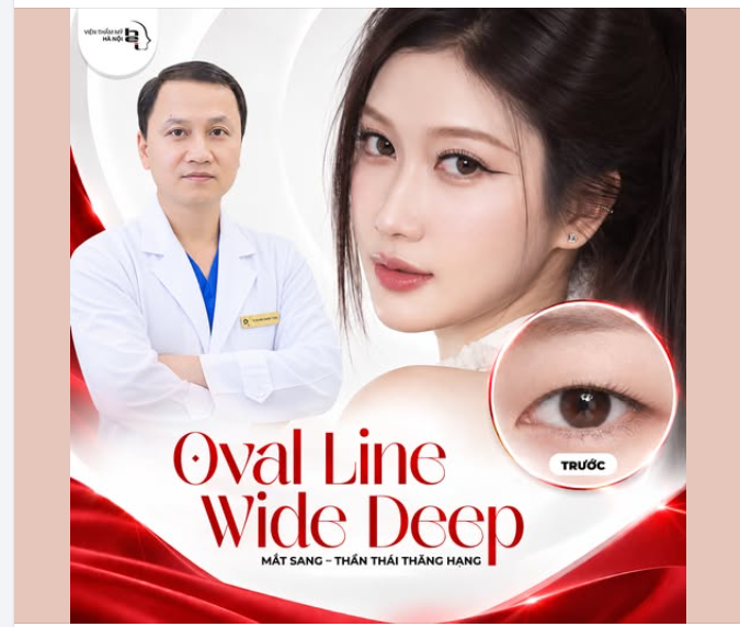 NHẤN MÍ OVAL LINE WIDE DEEP – MẮT SANG, THẦN THÁI THĂNG HẠNG
