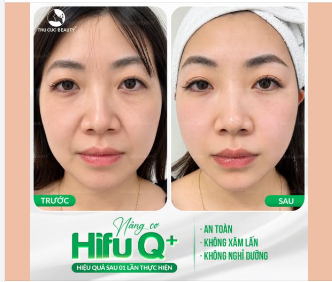 NÂNG CƠ SĂN CHẮC – TRẺ HÓA XÓA NHĂN CÙNG HIFU Q+