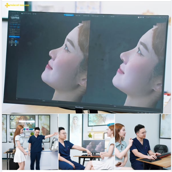 Chưa nâng mũi nhưng MC Minh Hà đã được ngắm trước dáng mũi mới của mình