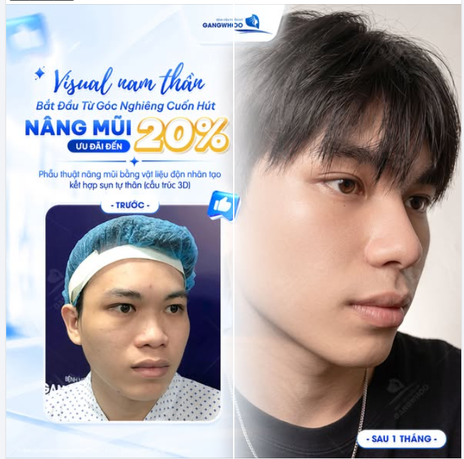 VISUAL NAM THẦN BẮT ĐẦU TỪ GÓC NGHIÊNG CUỐN HÚT