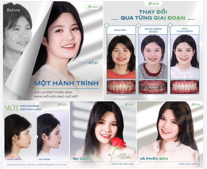 HÀNH TRÌNH HOÀN THIỆN NỤ CƯỜI TỪ NHỮNG ĐIỀU NHỎ NHẤT