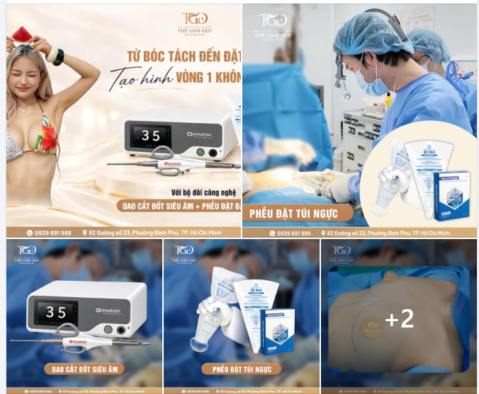 Từ bóc tách đến đặt túi: Tạo hình V.òng 1 KHÔNG CHẠM