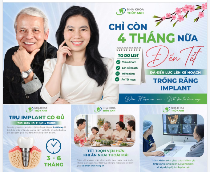 4 THÁNG NỮA ĐẾN TẾT – ĐÃ ĐẾN LÚC LÊN KẾ HOẠCH TRỒNG RĂNG IMPLANT!