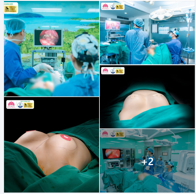 NÂNG NGỰC NỘI SOI ĐƯỜNG NÁCH - V1 CĂNG ĐẦY, ĐẸP KHÔNG TÌ VẾT