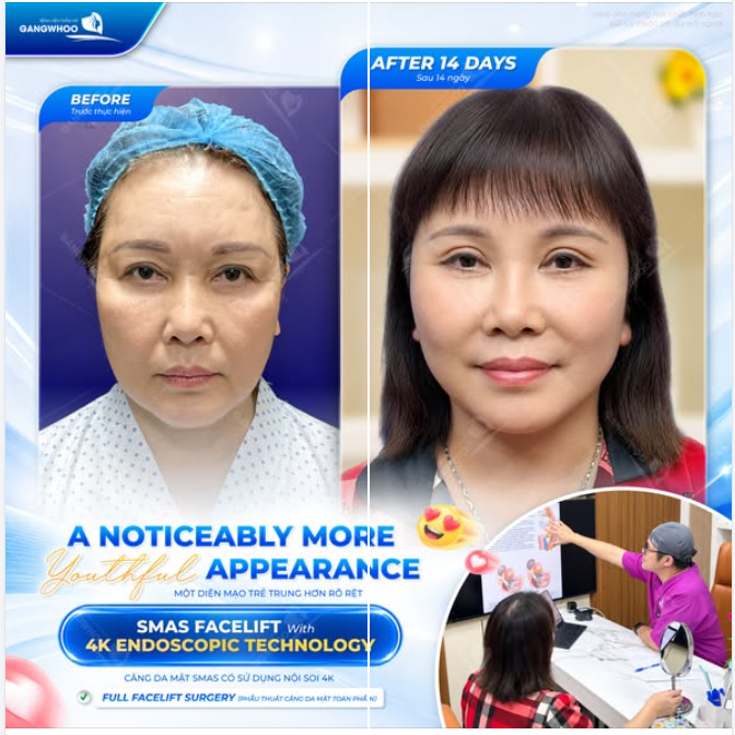 MỘT DIỆN MẠO TRẺ TRUNG HƠN RÕ RỆT