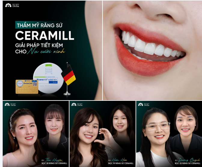 CERAMILL — GIẢI PHÁP TIẾT KIỆM CHO NỤ CƯỜI XINH