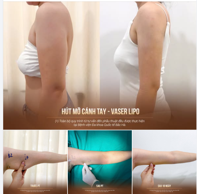 TỰ TIN DIỆN MỌI TRANG PHỤC VỚI CÁNH TAY THANH THOÁT