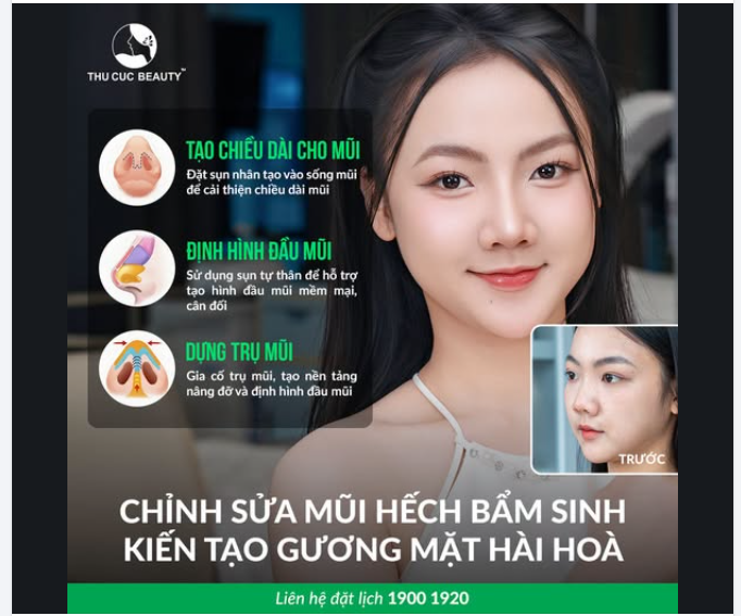 CHỈNH SỬA MŨI HẾCH BẨM SINH  Kiến tạo dáng mũi hài hoà