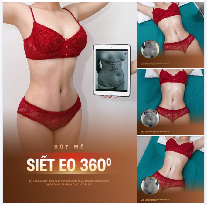 KHÔNG PHẢI CỨ GIẢM CÂN LÀ ĐƯỜNG EO SẼ RÕ NÉT HƠN