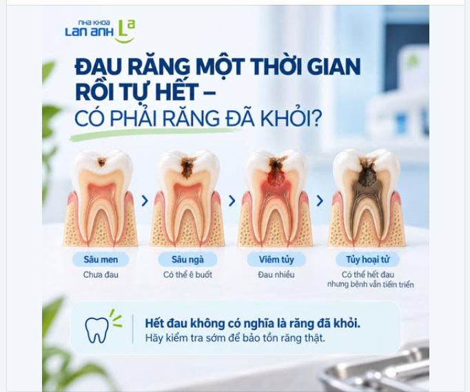 ĐAU RĂNG MỘT THỜI GIAN RỒI TỰ HẾT - CÓ PHẢI RĂNG ĐÃ KHỎI?