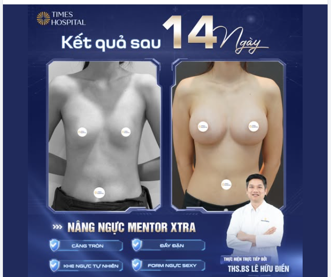 NÂNG CẤP V1 - CHỌN DÒNG TÚI CAO CẤP MENTOR XTRA