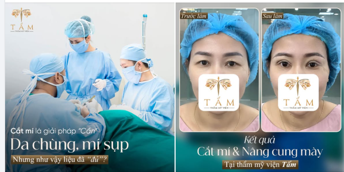 CẮT MÍ LÀ GIẢI PHÁP "CẦN" CHO DA CHÙNG, MÍ SỤP - NHƯNG NHƯ VẬY ĐÃ "ĐỦ"?