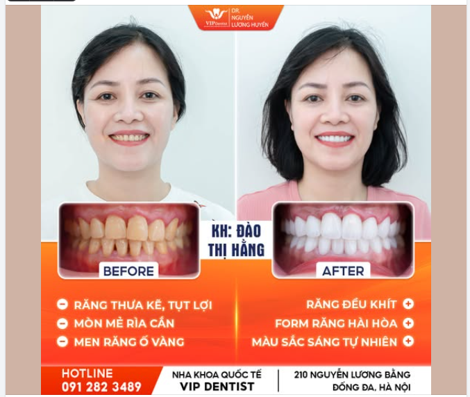 THAY ĐỔI BẤT NGỜ - RẠNG NGỜI THẦN THÁI
