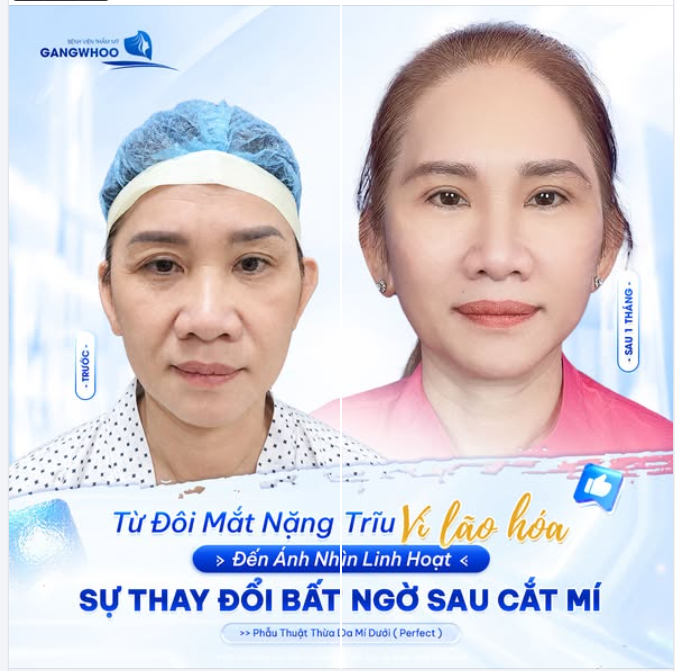 TỪ ĐÔI MẮT NẶNG TRĨU VÌ LÃO HÓA