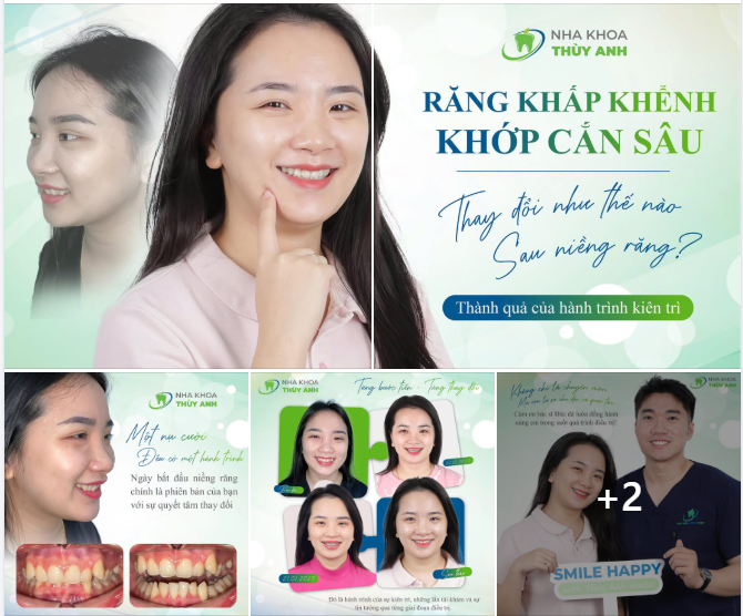 THÁO NIỀNG, HẾT KHẤP KHỂNH VÀ THẬT TỰ TIN VỚI NỤ CƯỜI MỚI