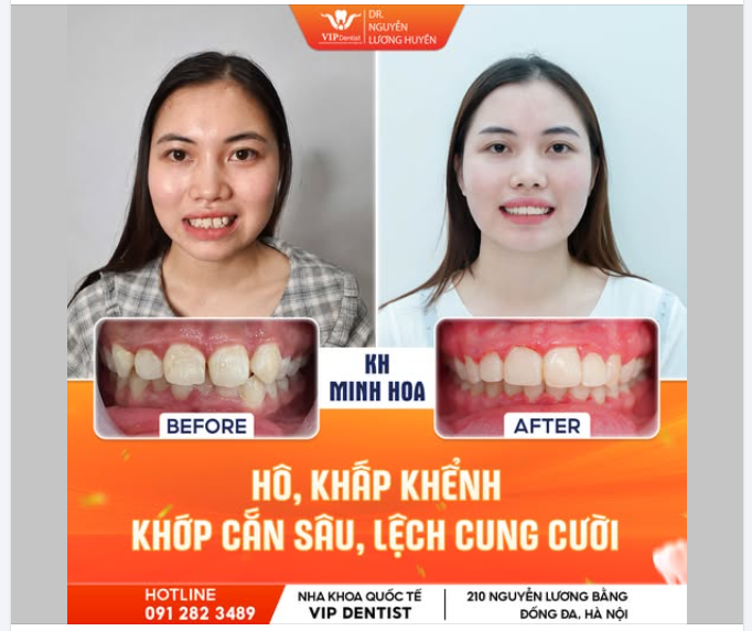 KHUÔN MẶT HÀI HÒA - NỤ CƯỜI CÂN ĐỐI