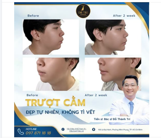 TRƯỢT CẰM NAM GIỚI: ĐẸP TỰ NHIÊN, KHÔNG TÌ VẾT