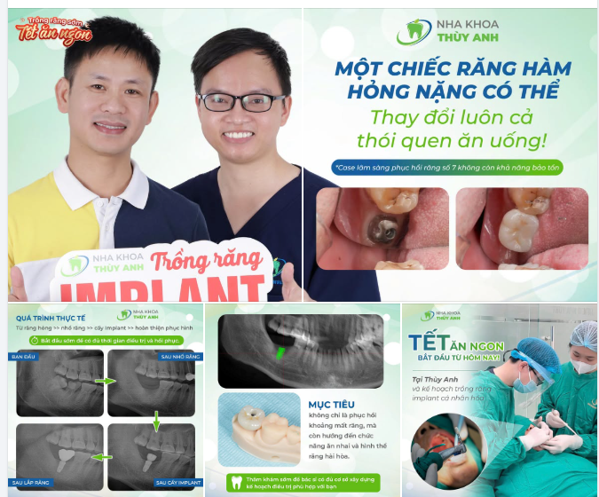 HỎNG RĂNG HÀM, ĂN UỐNG KHÓ CHỊU, ĐAU NHỨC – ĐỪNG KÉO DÀI ĐẾN TẾT!