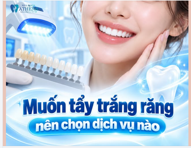 MUỐN TẨY TRẮNG RĂNG NÊN CHỌN DỊCH VỤ NÀO: TRƯỚC HẾT PHẢI BIẾT RĂNG MÌNH VÀNG VÌ ĐÂU.
